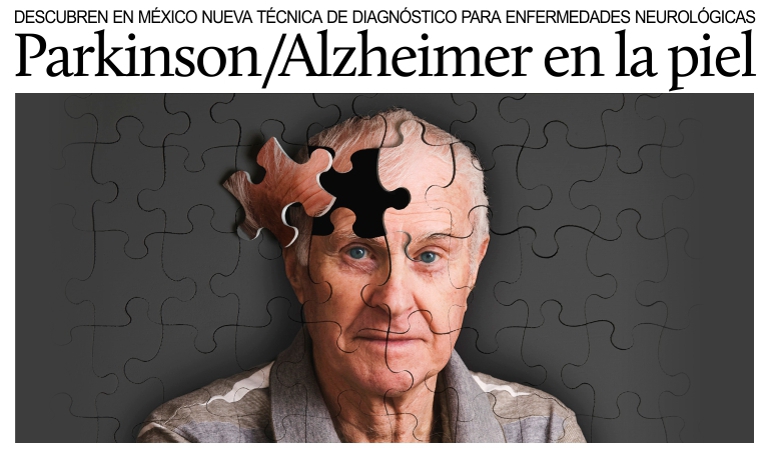 Descubren en M�xico nueva t�cnica de diagn�stico para las enfermedades de Parkinson y Alzheimer